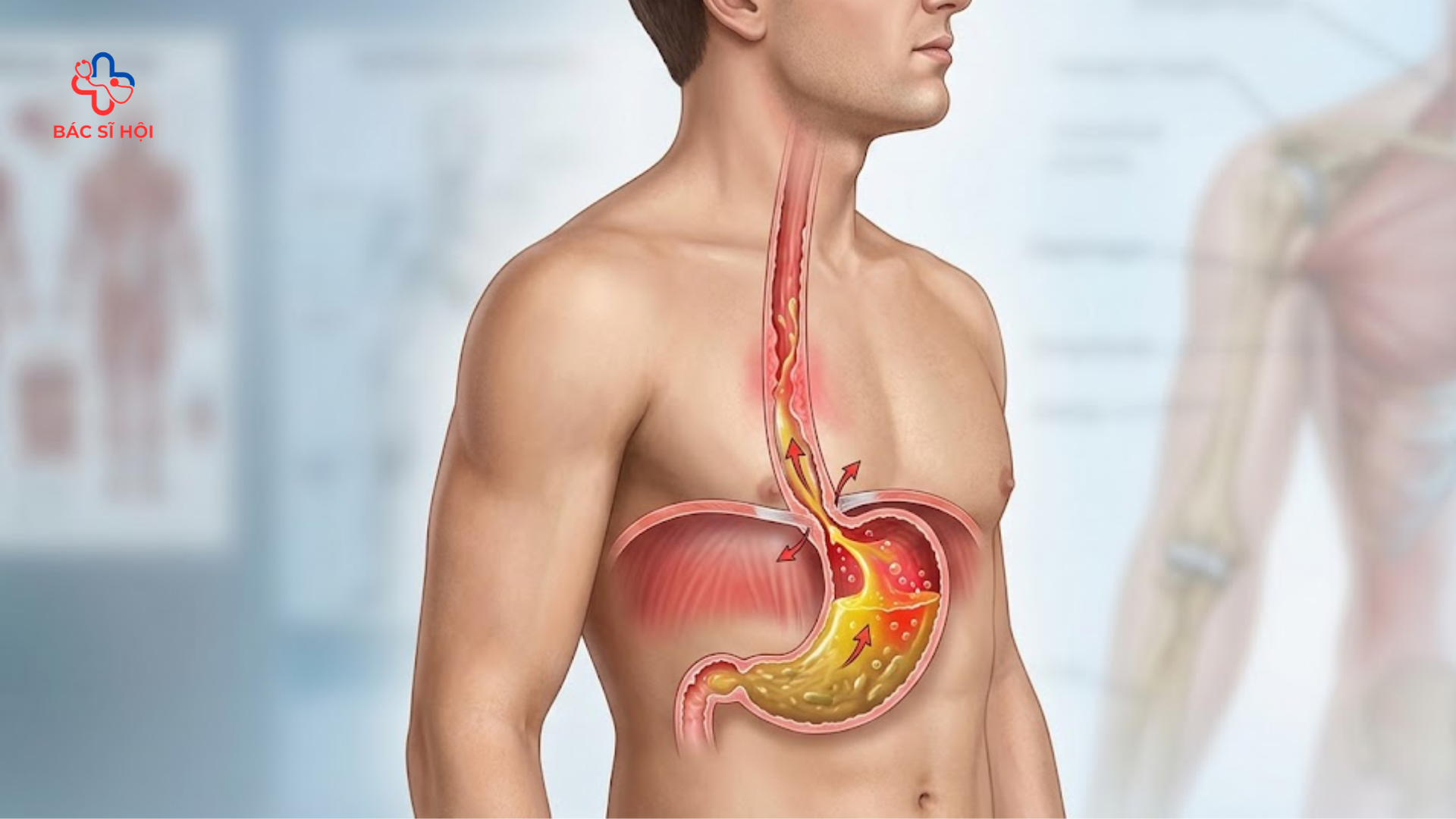 Cách trị trào ngược dạ dày tại nhà: Điều nhiều người làm chưa đúng