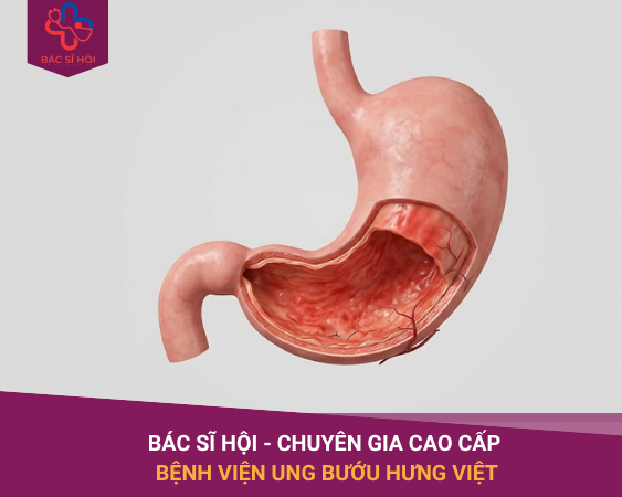 ẢNH SEO WEB BS HỘI (2)